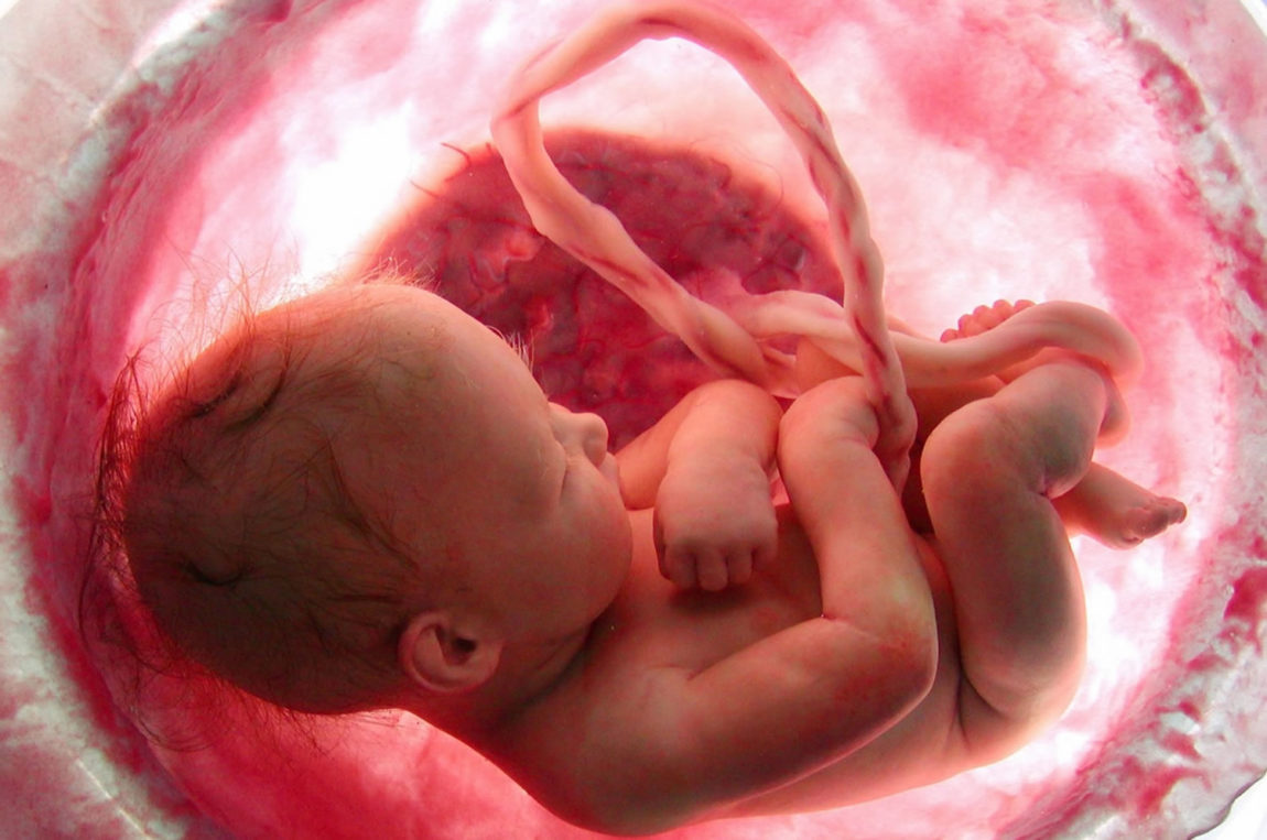 Risarcibilità del danno da omessa diagnosi della malformazione del feto