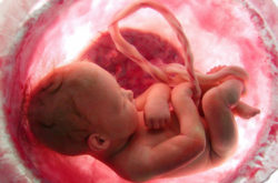 La posizione del “nascituro”. Dall’interruzione della gravidanza alla procreazione medicalmente assistita