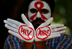 HIV e AIDS: la configurabilità delle circostanze nel delitto di lesioni personali