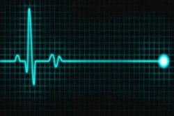 L’evoluzione e le varie sottocategorie del danno terminale