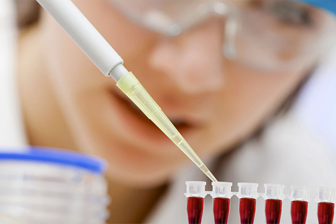 Prelievo coattivo di campioni biologici da persona vivente – artt. 349 c. 2-bis e 359-bis c.p.p.