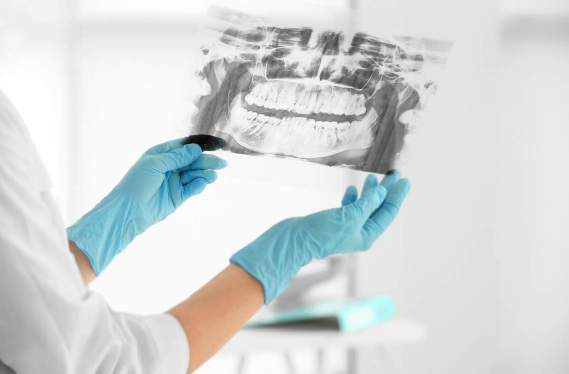 L’esercizio abusivo della professione di Odontoiatra